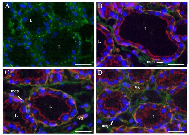 Marquage de l’actine musculaire lisse révélée par un anticorps secondaire couplé au FICT